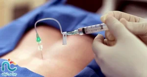 تزریق کورتون در دیسک کمر