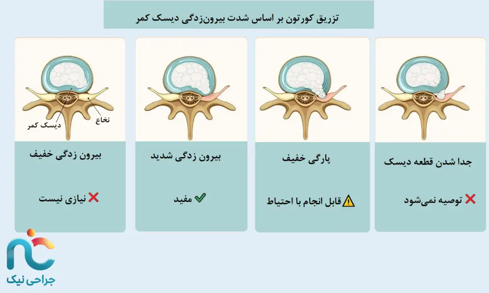 انتخاب تزریق کورتون برای دیسک کمر