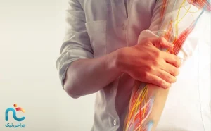درد عصبی شانه، دست و انگشتان