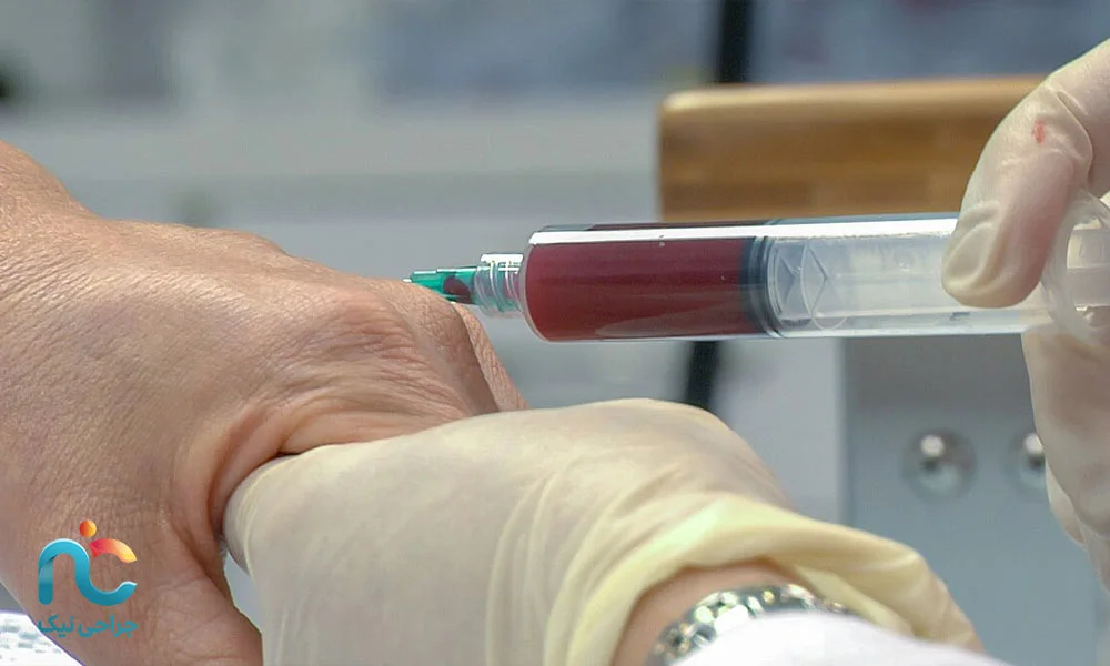 نمونه‌گیری