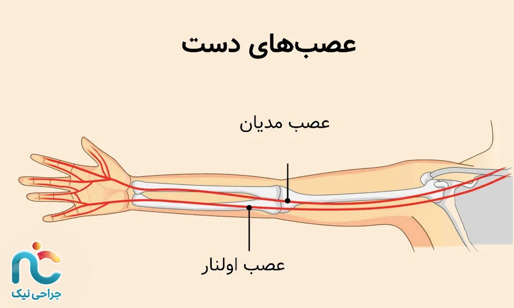 تونل کارپال