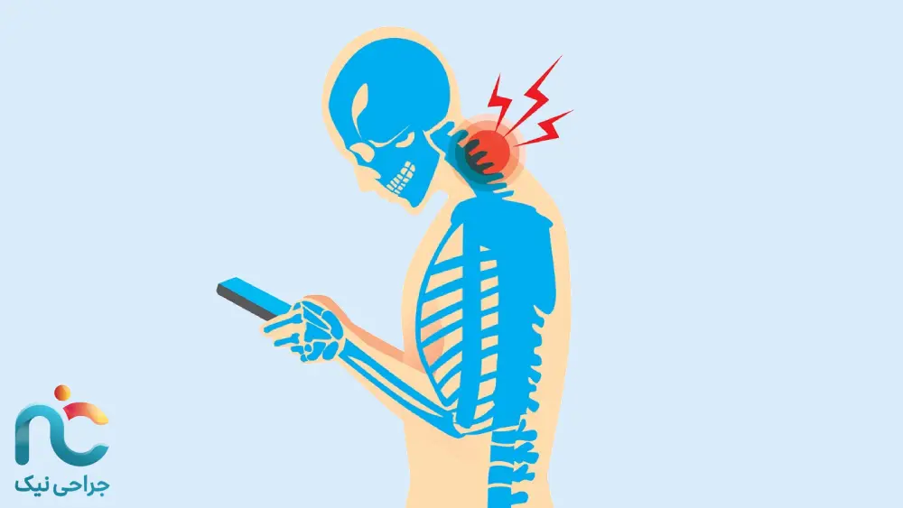 گردن پیامکی