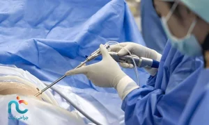 جراحی اندوسکوپیک دیسک گردن