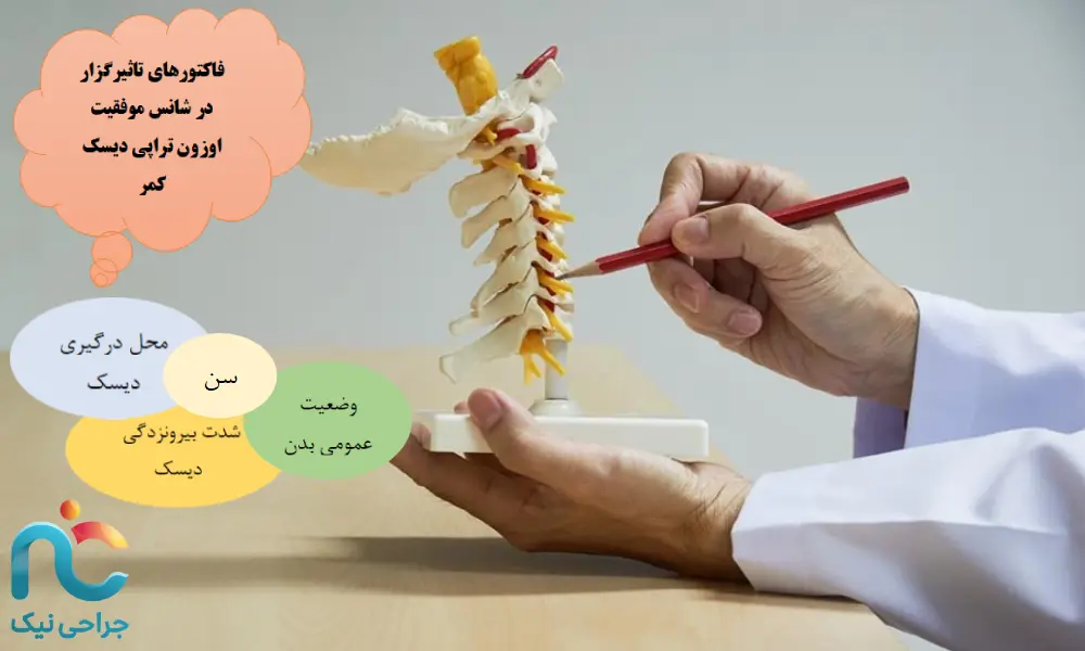 فاکتورهای تاثیرگزار در اوزون تراپی دیسک کمر