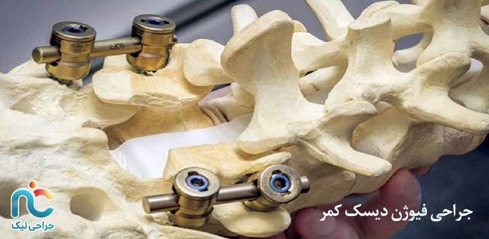 فورامینوتومی