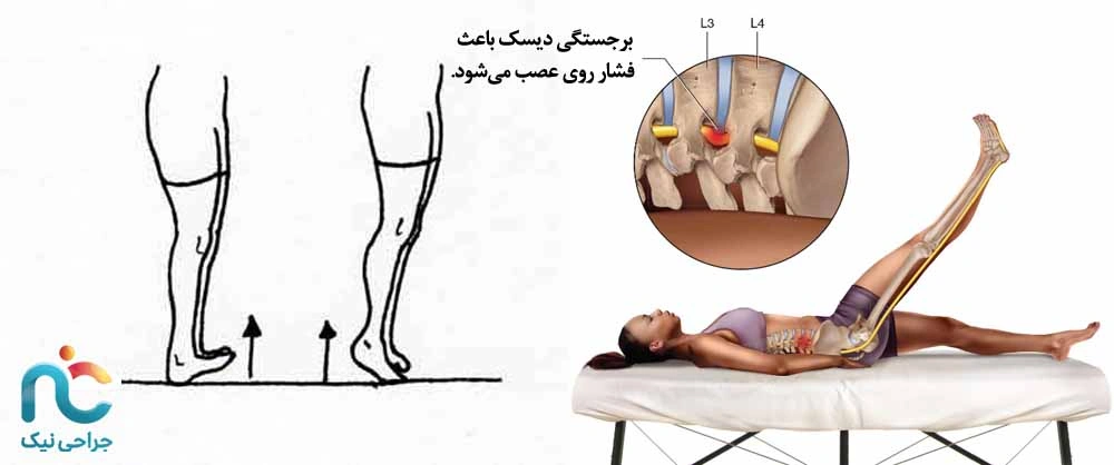 بررسی قدرت عضلات پا