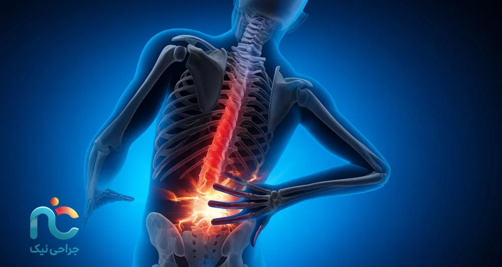 آیا تزریق اپیدورال کودال به درد شما می‌خورد یا نه؟