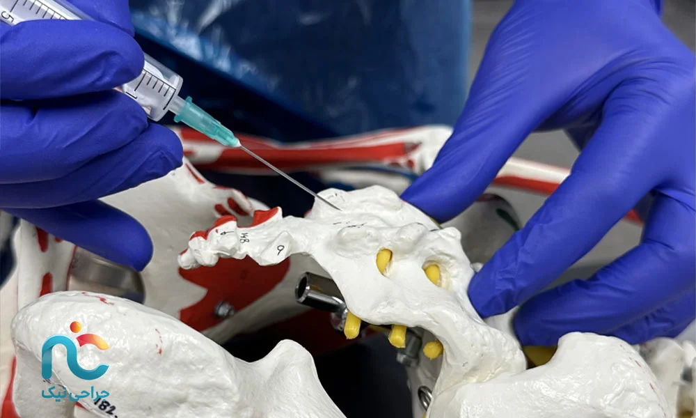 «کودال» به چه معنی است