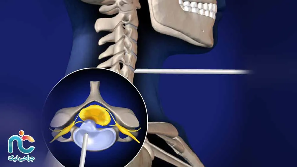 جراحی میکروسکوپی