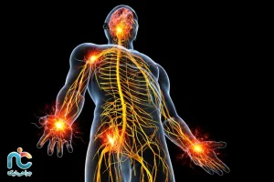 درد نوروپاتیک