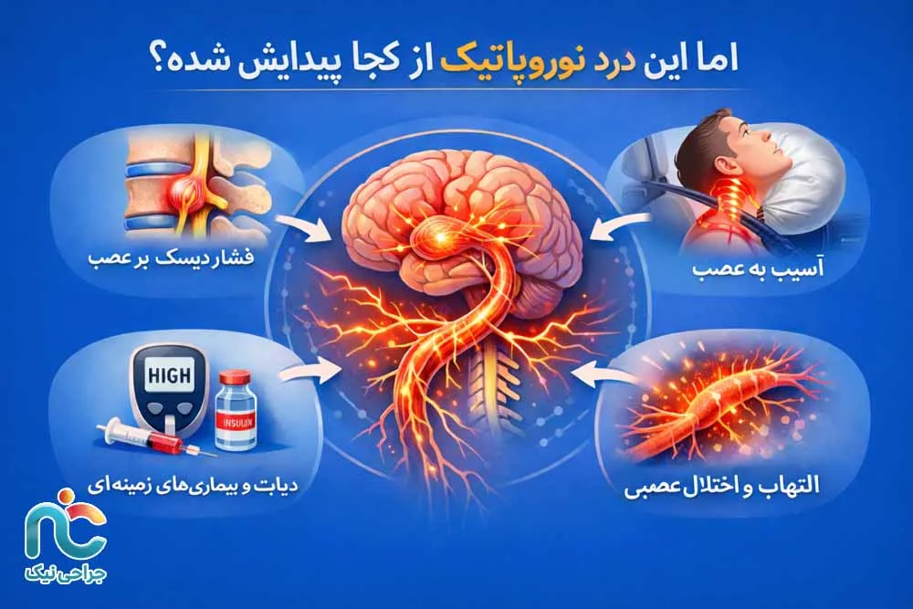 درد نوروپاتیک