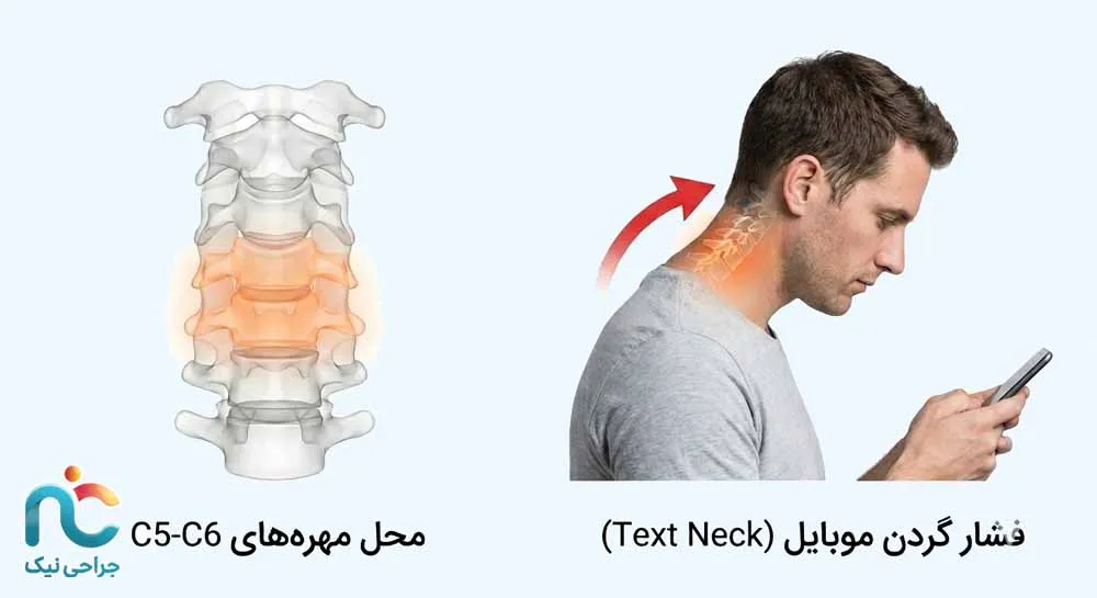 تغییرات استخوانی