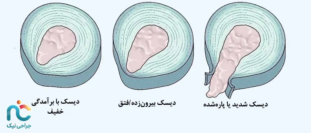 دیسک