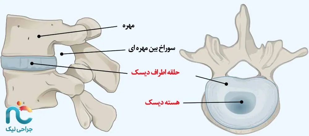 درجات کم آبی دیسک و درمان آن