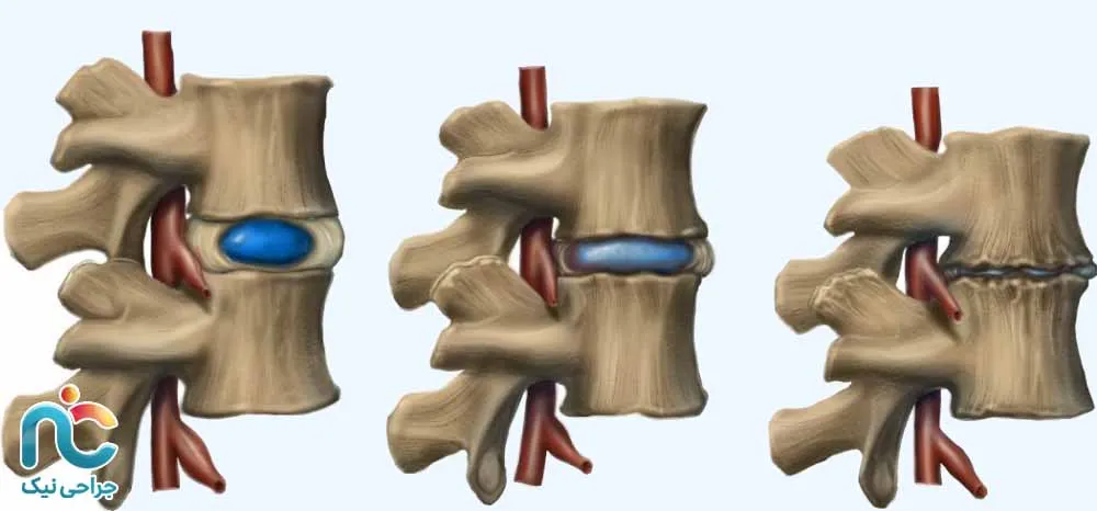 درجات مختلف کمآبی