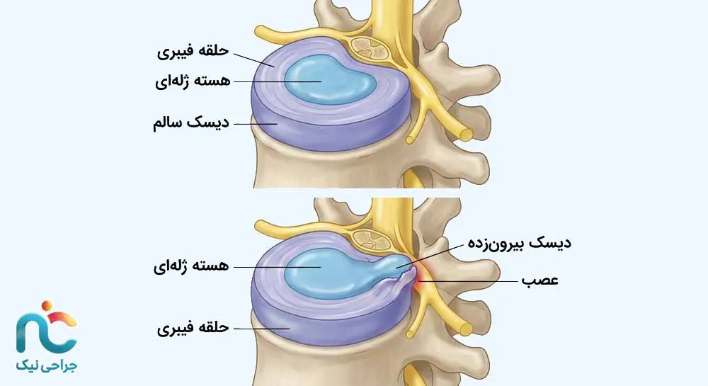 ام آر آی