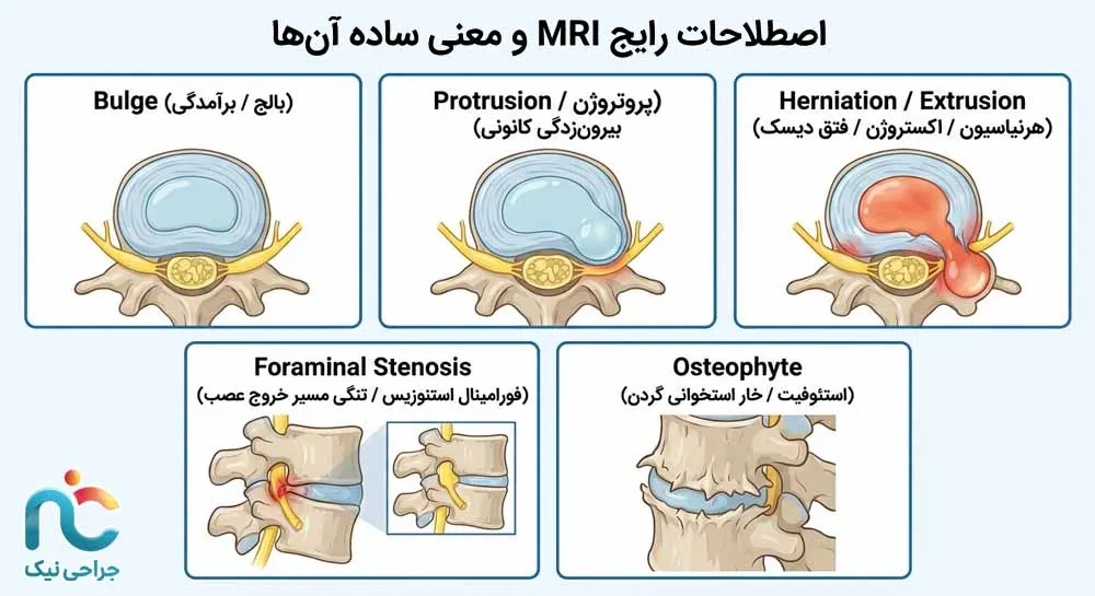 اصطلاحات