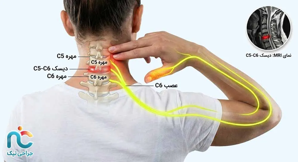 انتهای گردن