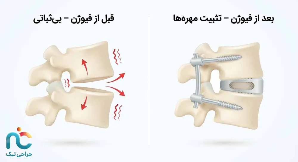فیوژن