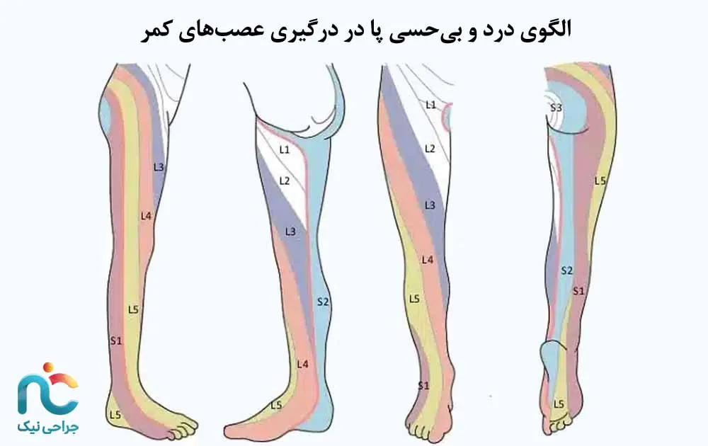 الگوی درد
